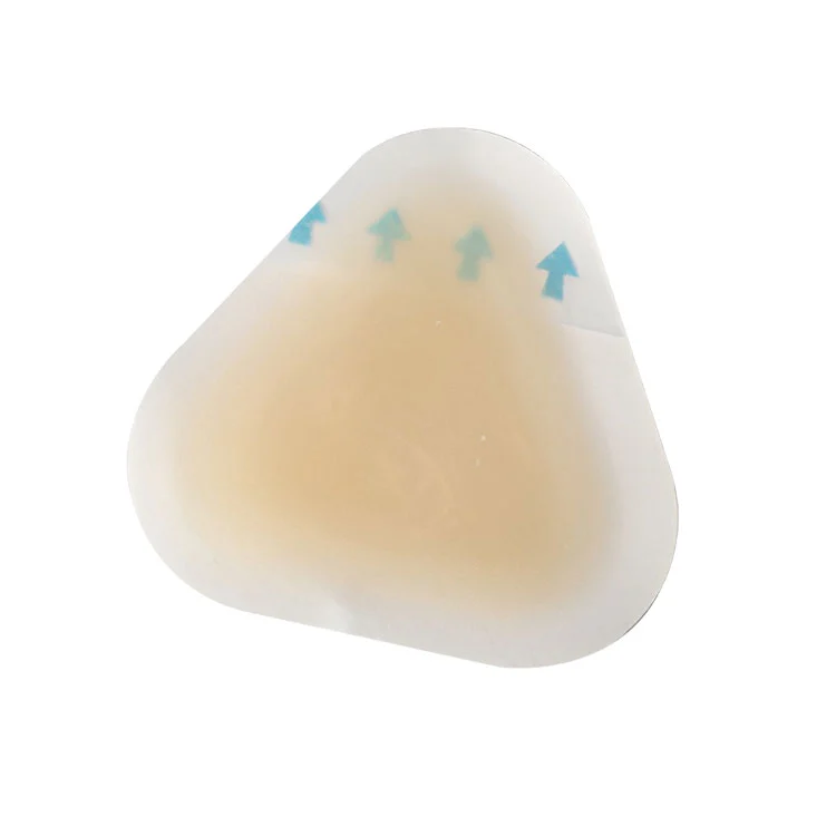 Превенција стерилних пликова за пете: Како можете заштитити своја стопала од бола, инфекције и оштећења од трења